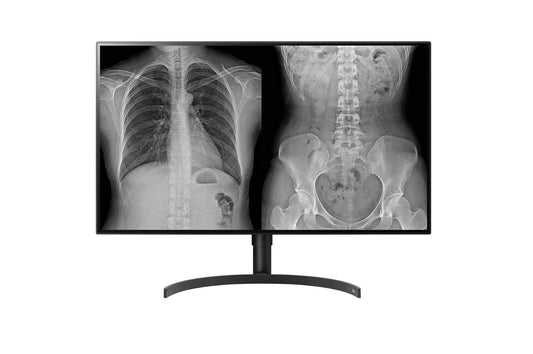 LG 32HL512D-B computer monitor 80 cm (31.5") 3840 x 2160 pixels Full HD LCD Black